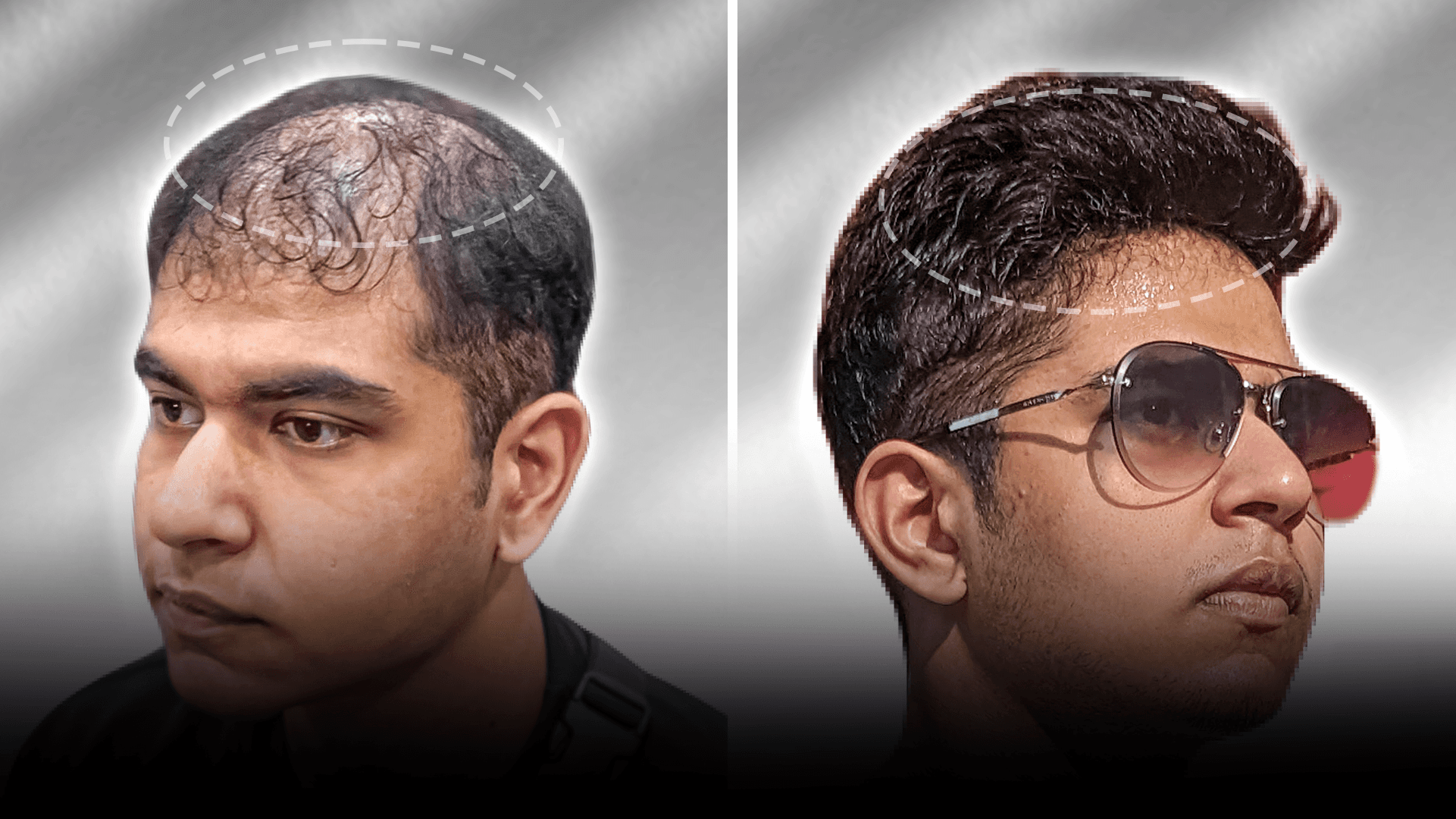 Before and after clip-on hair system result for Rylan Rodrigues.