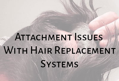 Attachment Issues With Hair Replacement Systems