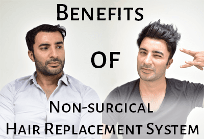 Benefits of Non-Surgical Hair Replacement Systems