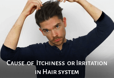 What Causes Itchiness or Irritation In Hair Systems?