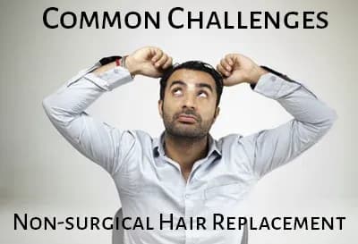 Common Challenges of Non- Surgical Hair Replacement