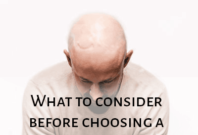 Things You Need To Consider Before Buying Hair Wigs