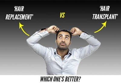 Is Hair Patch A Better Solution Then Hair Transplant