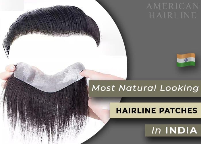 Most Natural Looking Hairline Patches in India