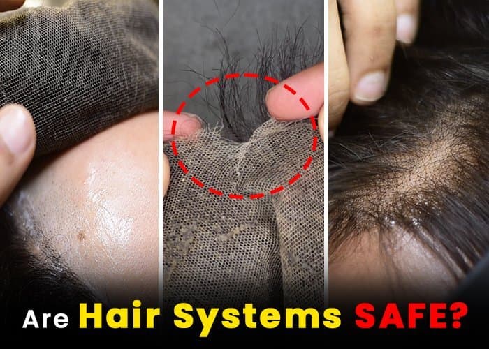 Are Hair Patches Safe?