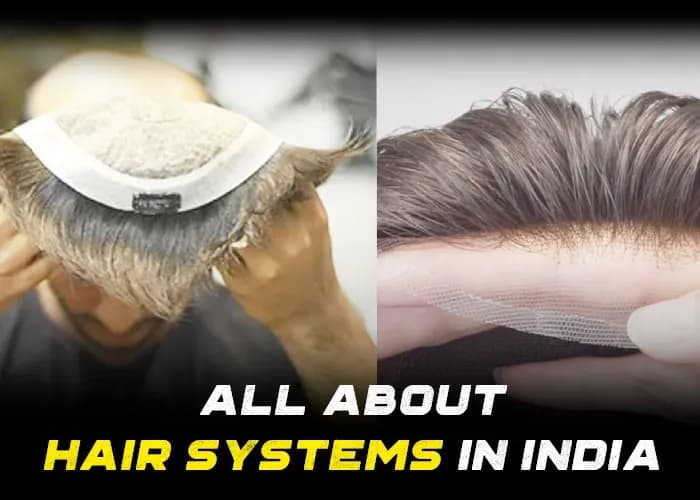 Everything You Need to Know About Hair Systems for Men