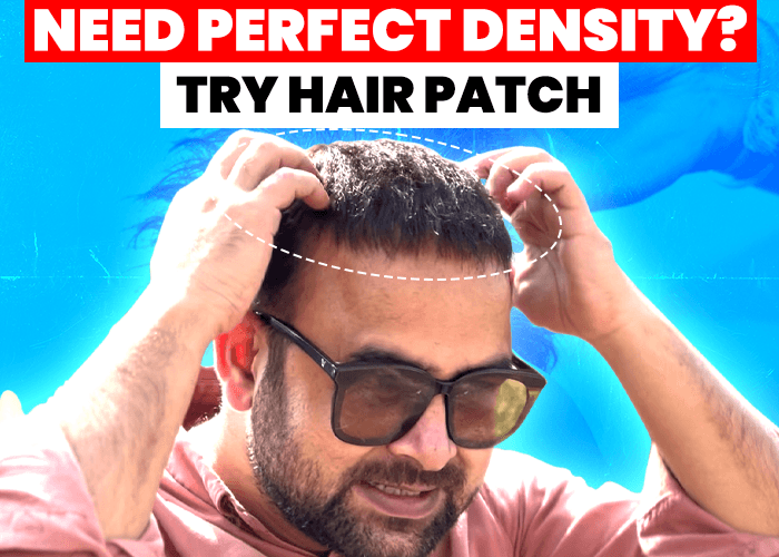 How to Achieve the Perfect Hair Density for a Natural Looking Hair Systems