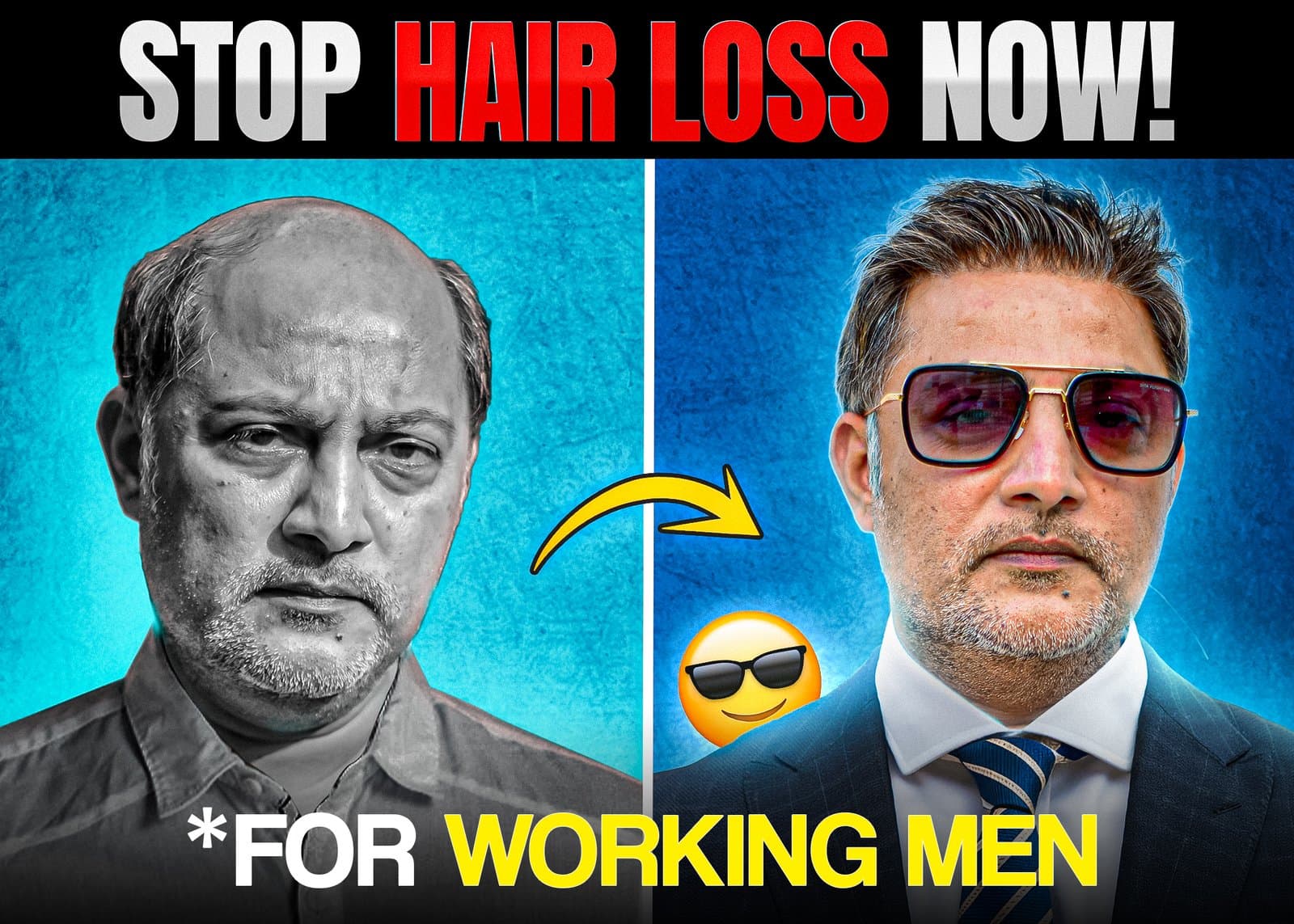 Quick Fix: Hair Loss Solutions for Men With Busy Lives