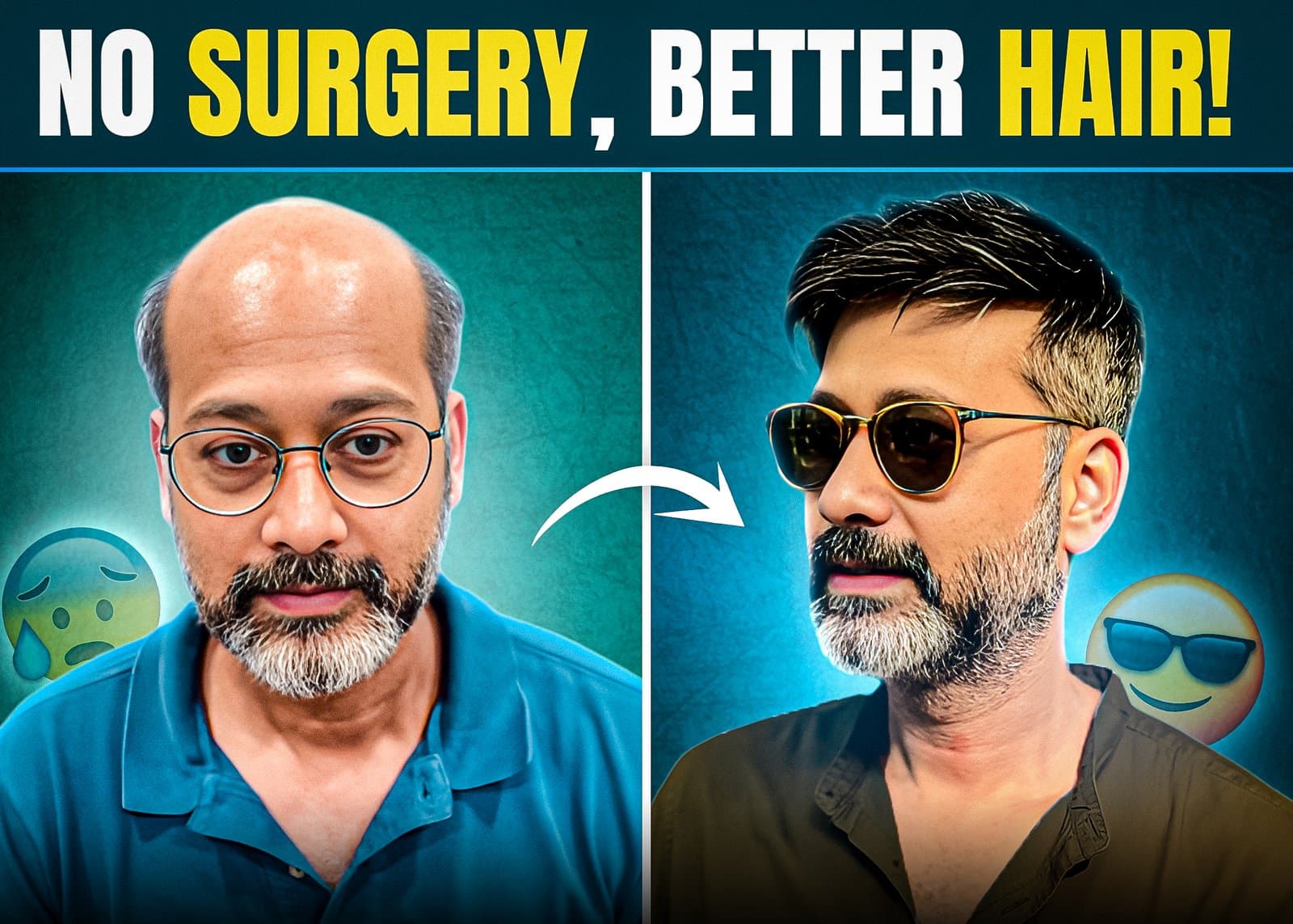 Top 5 Reasons Why Non-Surgical Hair Replacement Is the Secret Weapon of Confident Men