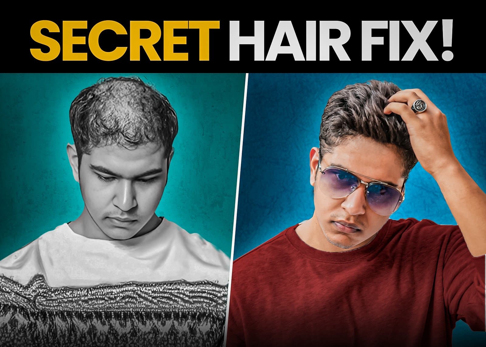 How Indian College Students Are Secretly Beating Hair Loss