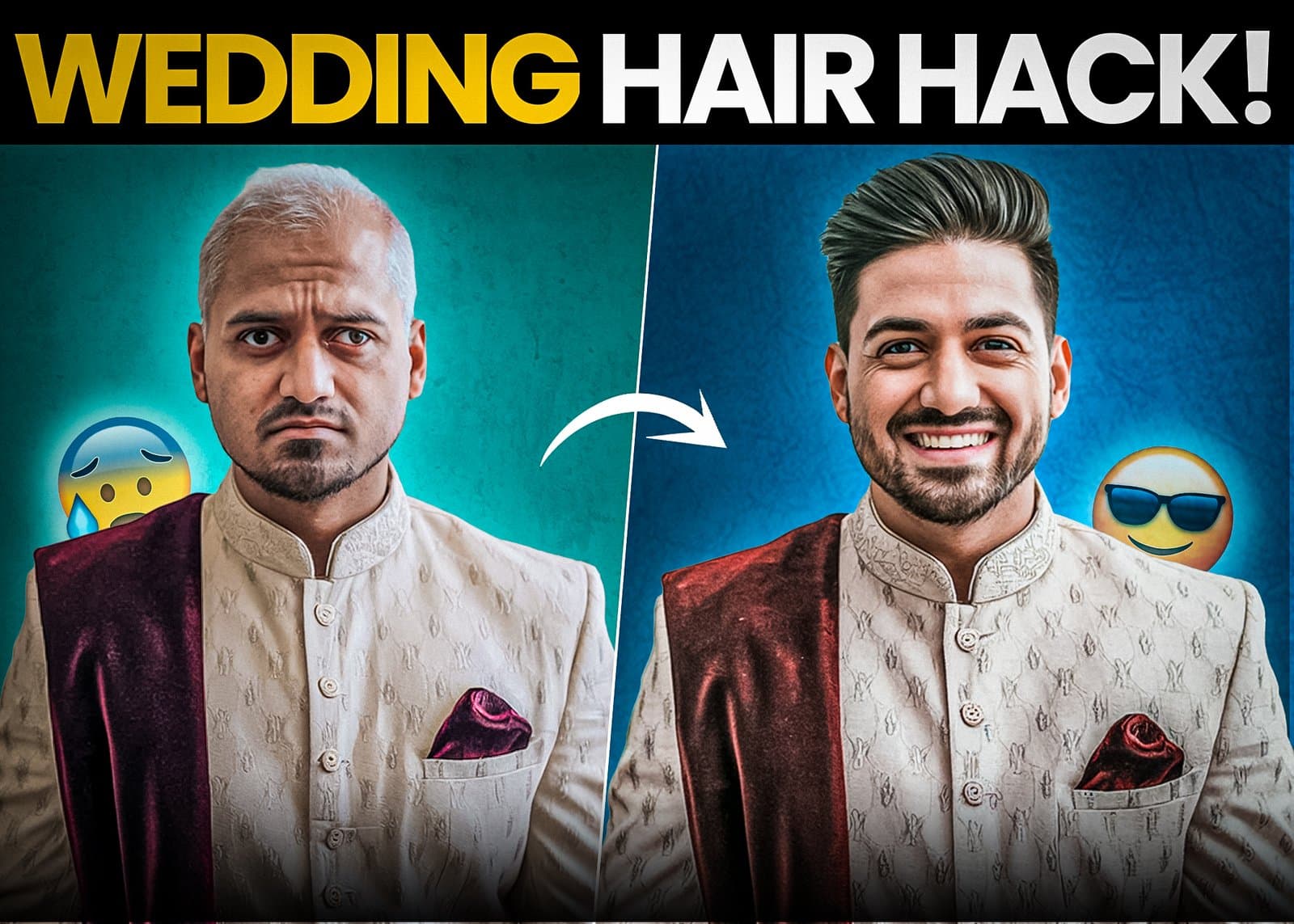 Are You Wedding-Photo Ready? The Ultimate Hair Fix for Grooms