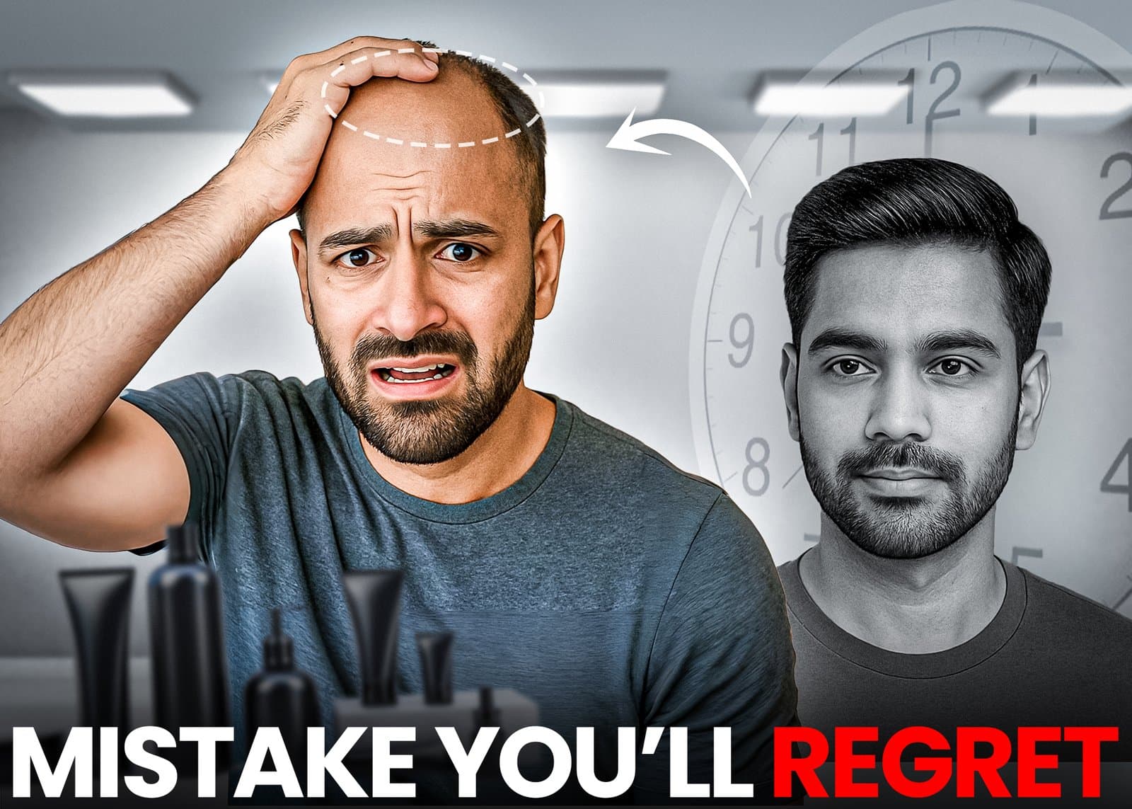 90% of Men Regret This Hair Loss Mistake Are You Making It?