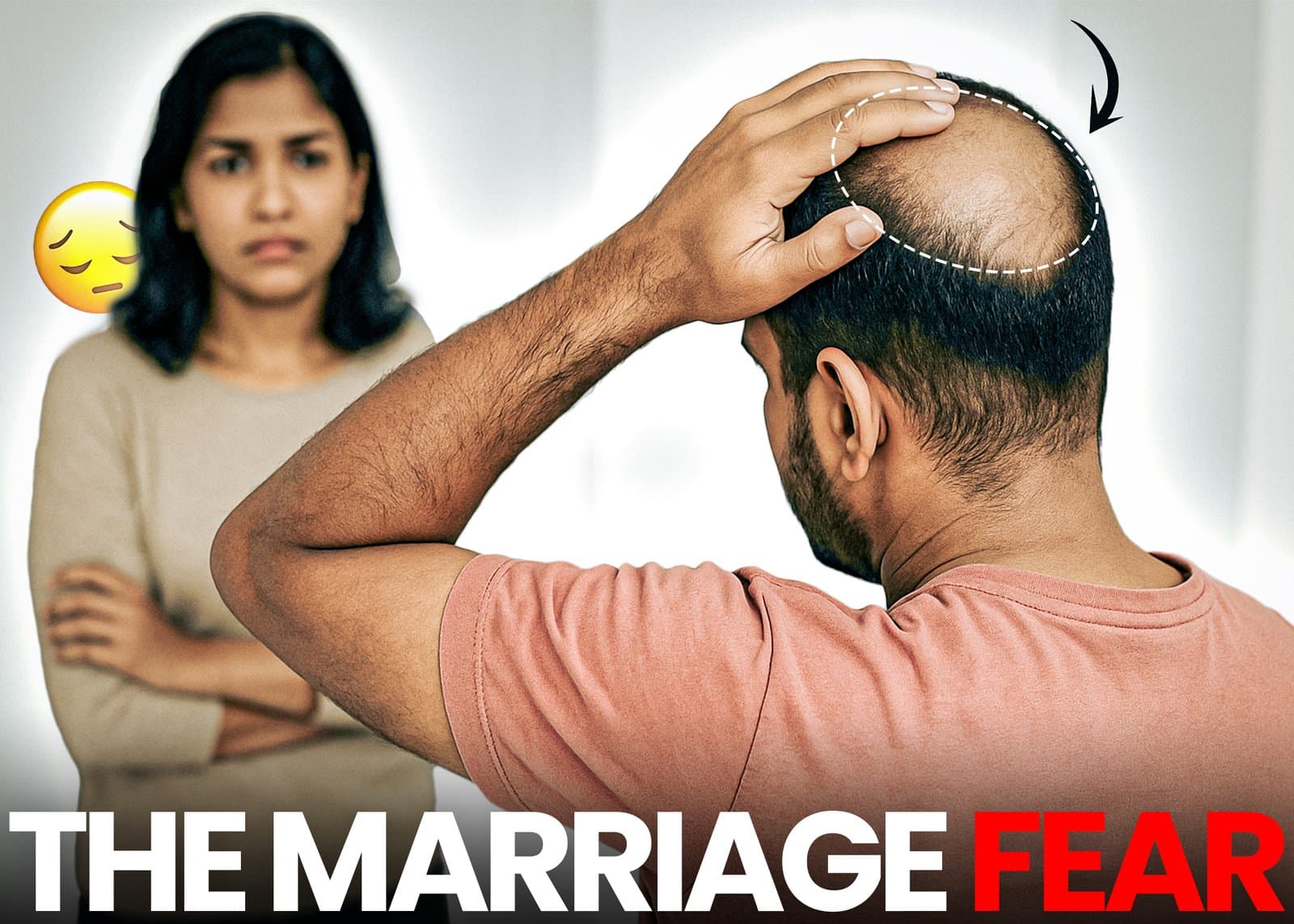 Bald Spots and Marriage: The Unspoken Fear No One Talks About