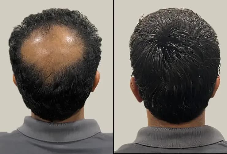 Grooming Tricks That Make You Look Younger Instantly