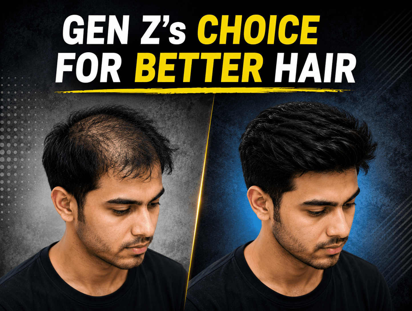 The New Trend: Why Gen Z Boys Love Low-Maintenance Hair Systems
