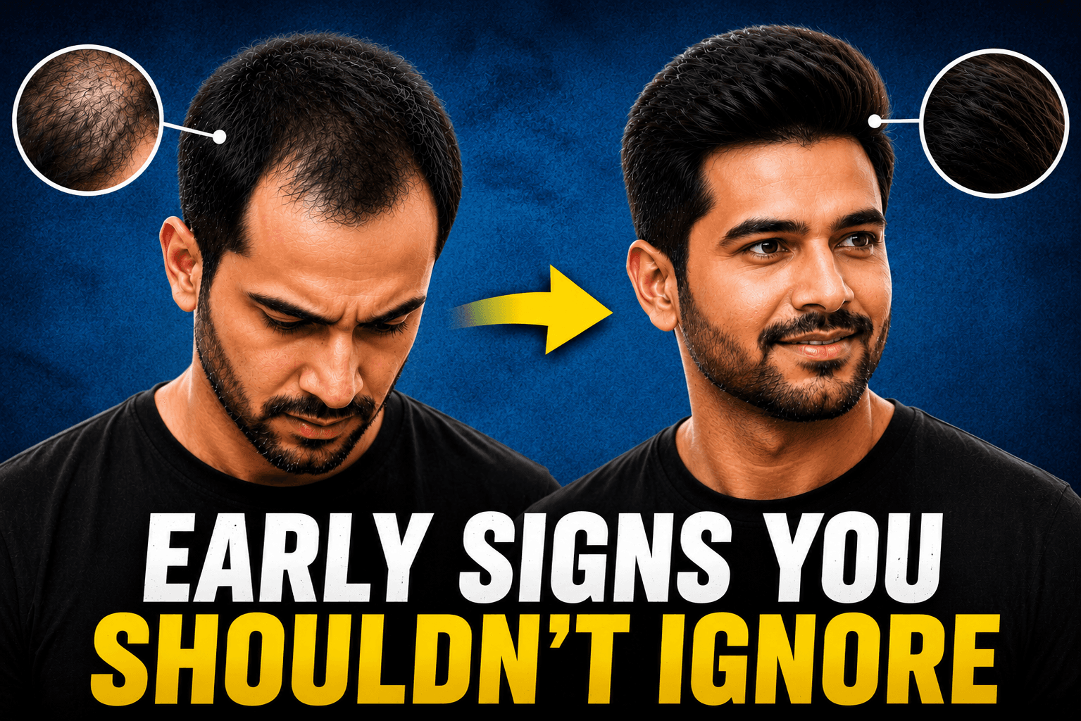 Stop Premature Balding Before Your Partner Notices the Change