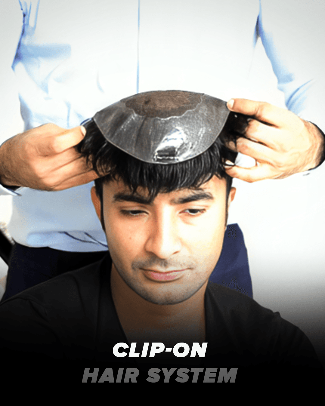 Clip-on hair system before and after result — natural hairline coverage without shaving (mobile)