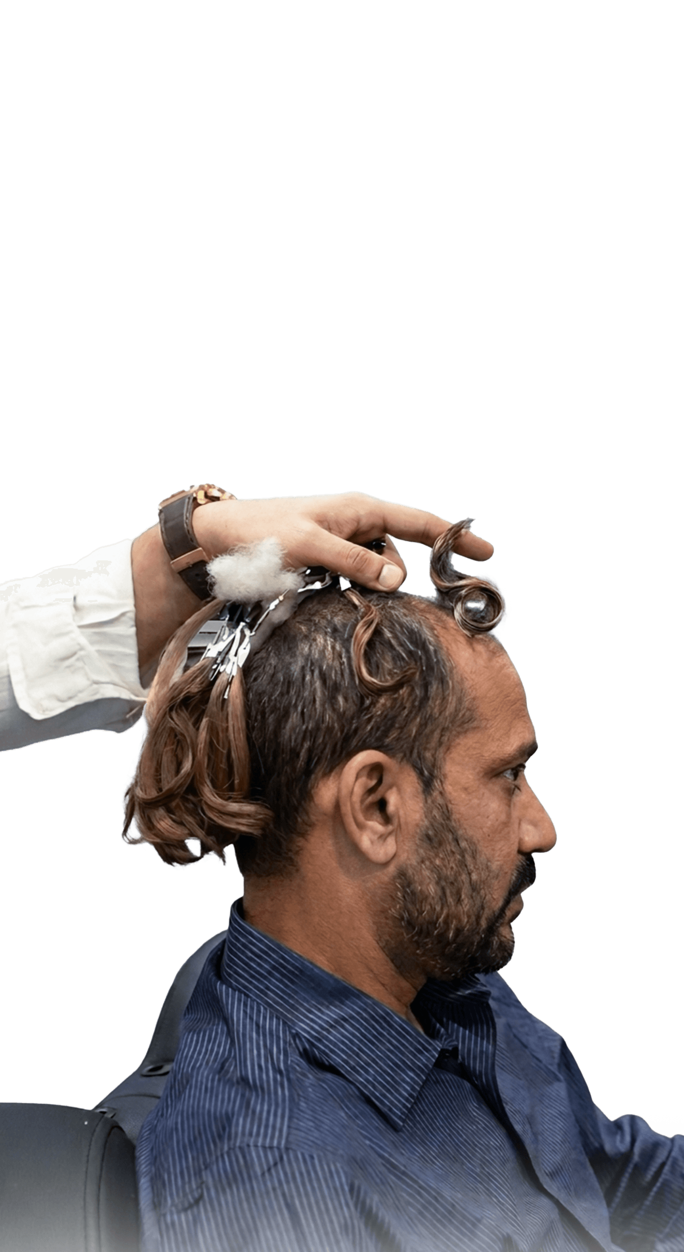 Consultation step showing a specialist designing a custom stick-on hair system.