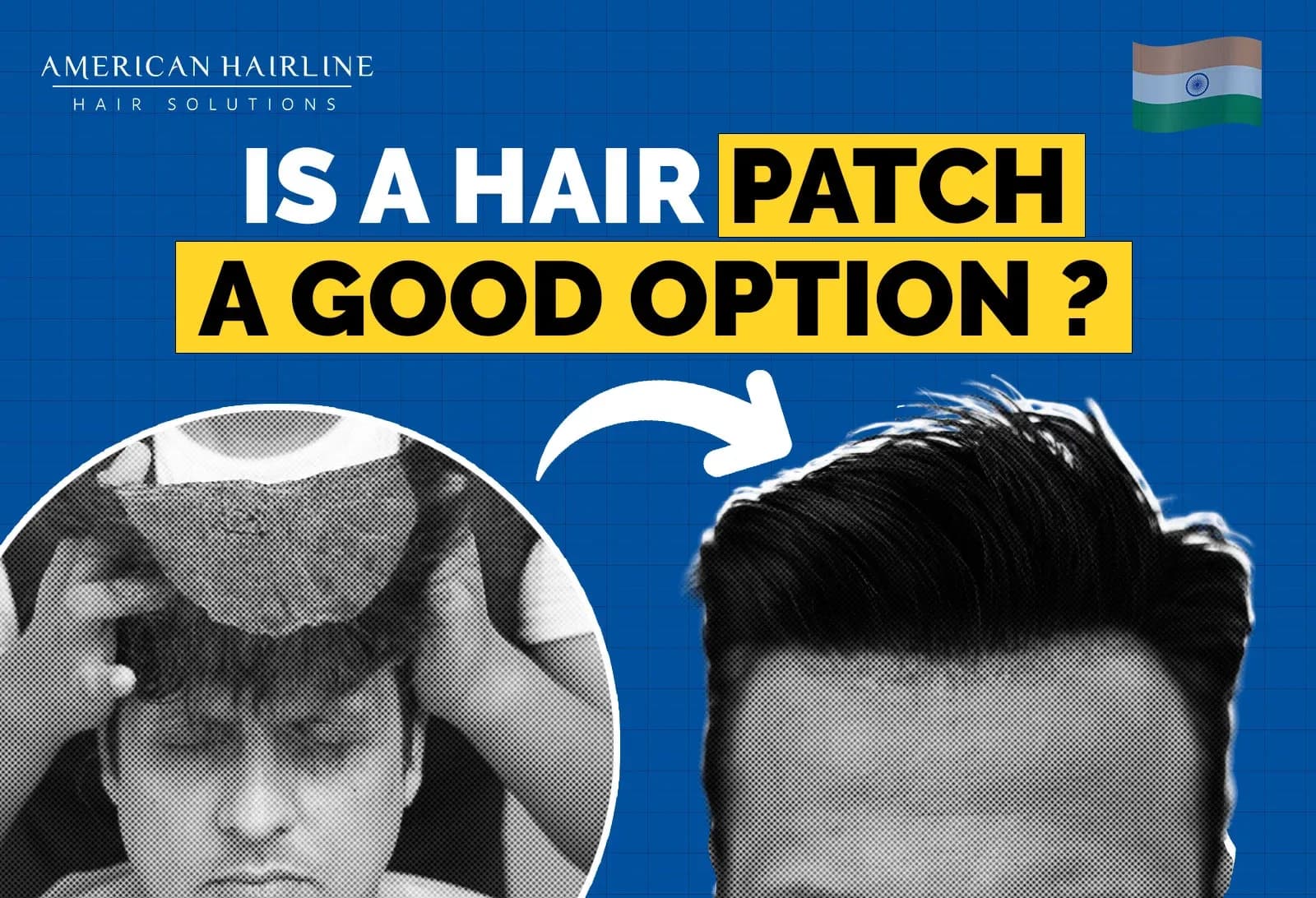 Is a Hair Patch a Good Option to opt for?