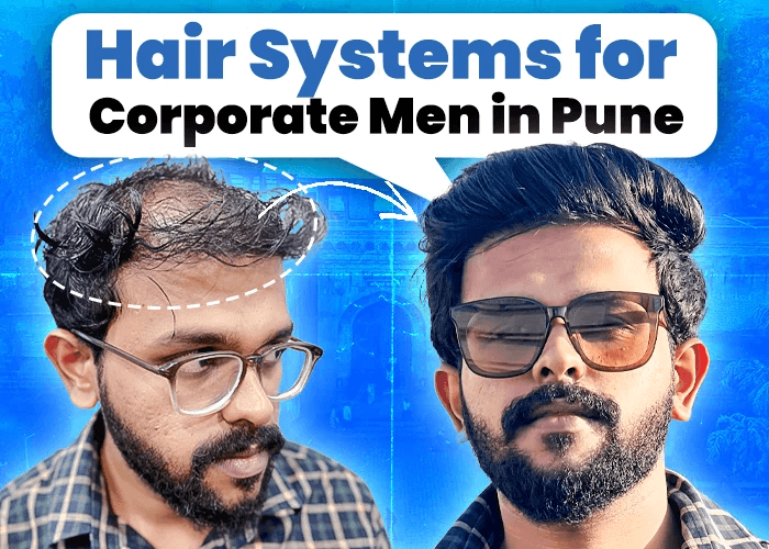 Hair Systems for Corporate Men in Pune