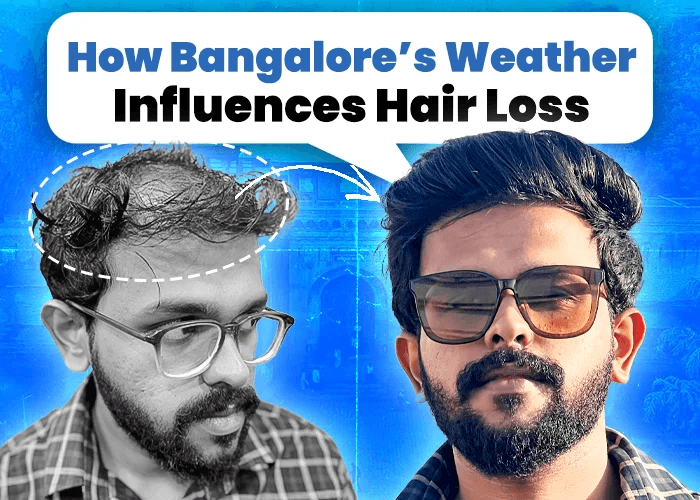 How Bangalore’s Weather Influences Hair Loss and What You Can Do