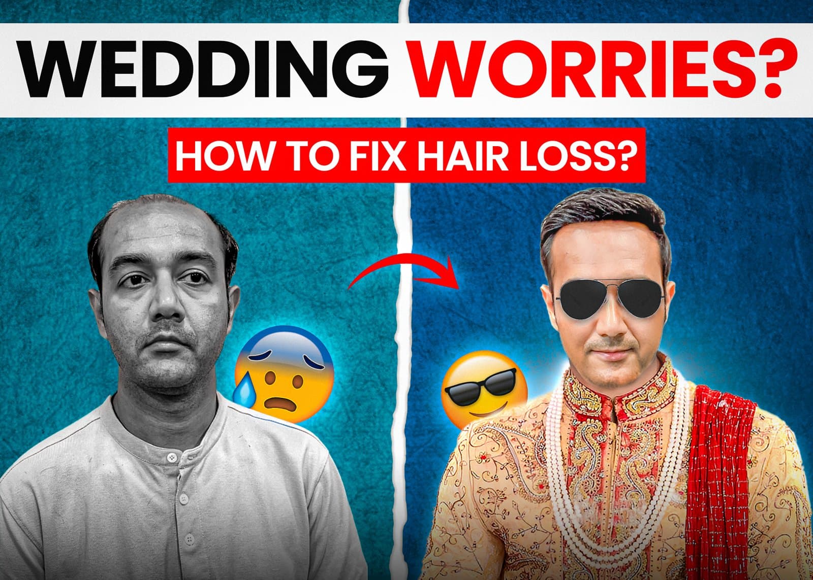 Wedding Worries? How to Fix Hair Loss Before the Big Day