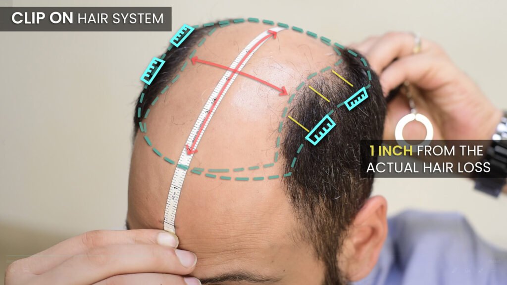 Clip on Hair Systems for Men NonSurgical Hair Replacement