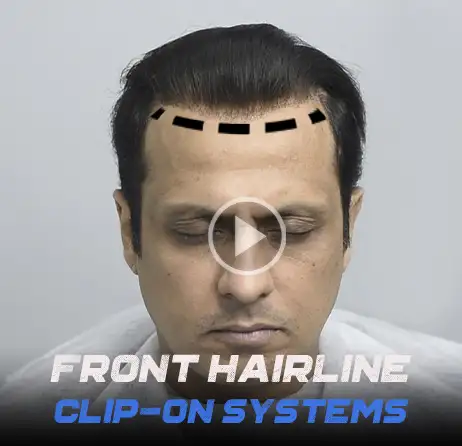 front hairline clip on hair systems