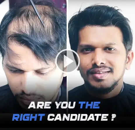 are you a right candidate for clip on hair patch