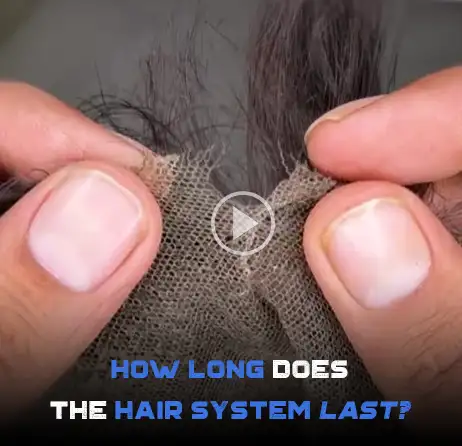 how does hair replacement systems last