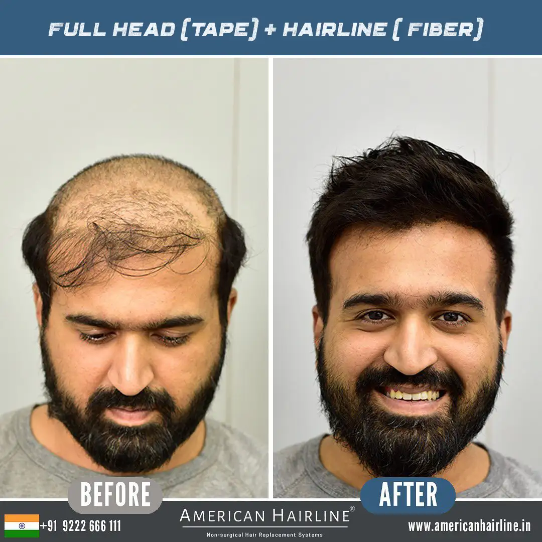 FULL HEAD TAPE+HAIRLINE FIBER