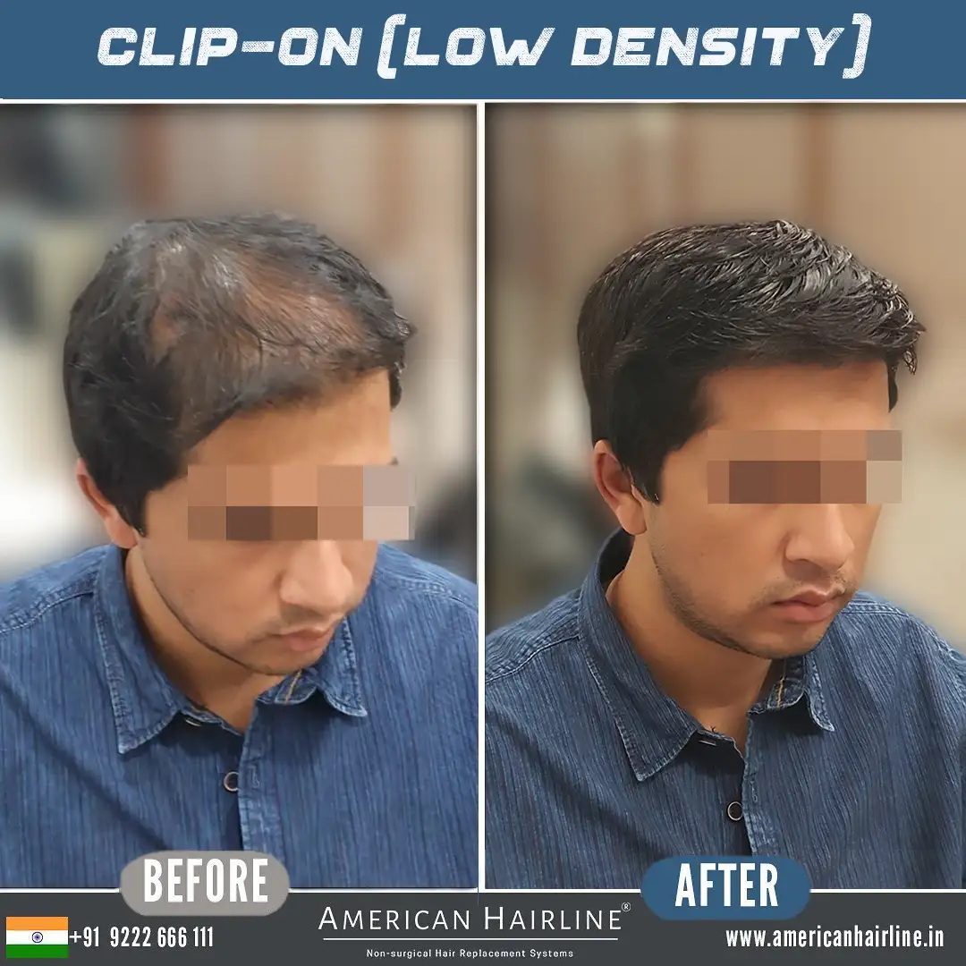 clip on low density