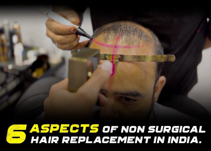 The Ultimate Guide to Non-Surgical Hair Replacement for Men in India