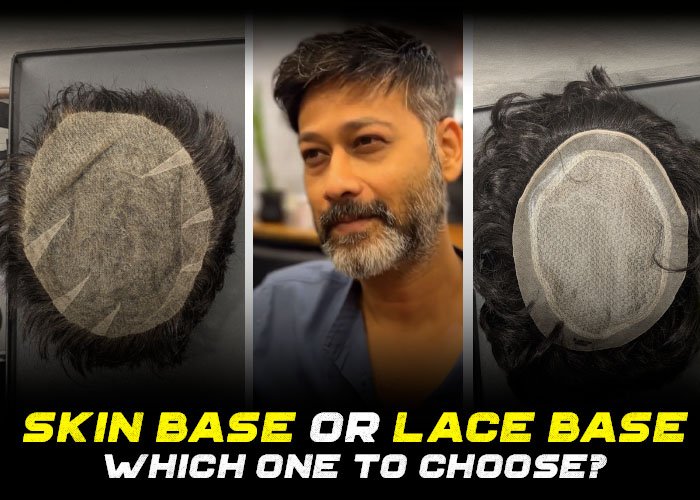 How to Choose a Base Type? Skin Base or Lace Base Hair Systems?