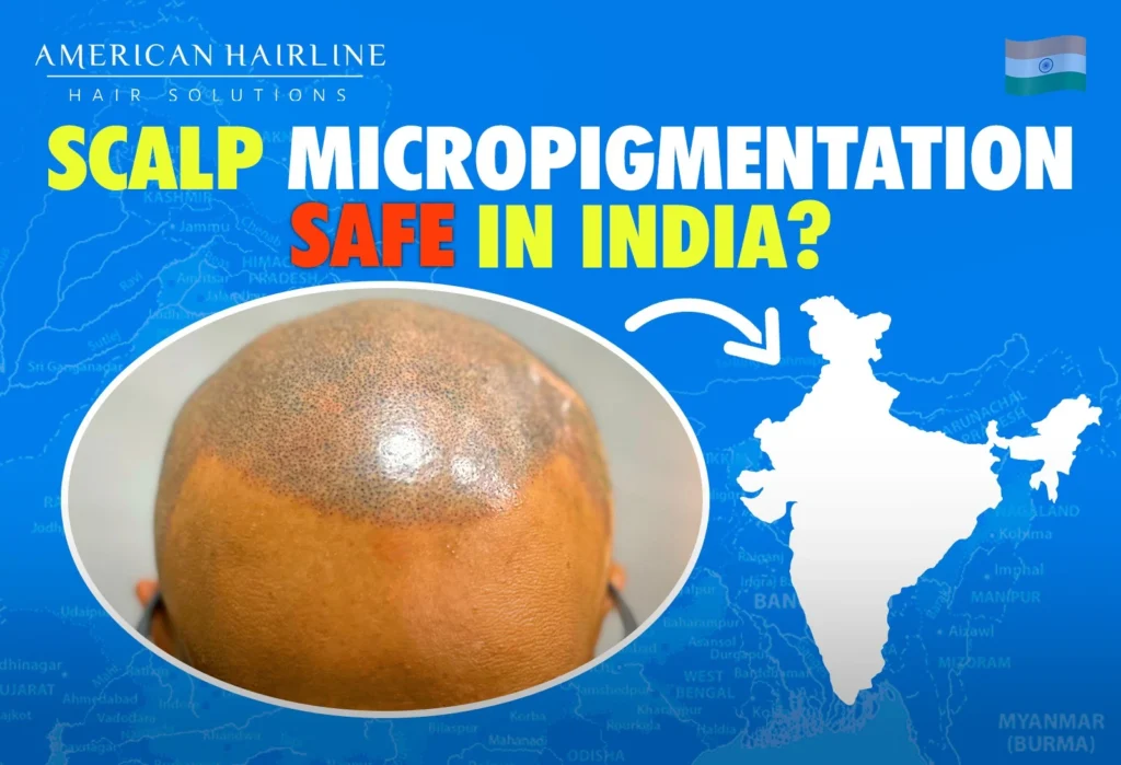 The image for a scalp micropigmentation service by American Hairline. It features a close-up view of the top of a person's head with micropigmentation treatment, showcasing the detailed work that mimics hair follicles. The background has a map of India, with a focus on the Indian subcontinent highlighted in blue and white, along with the Indian flag in the top right corner. The text reads "SCALP MICROPIGMENTATION SAFE IN INDIA?" indicating a promotional emphasis on the safety of the procedure in the Indian context.