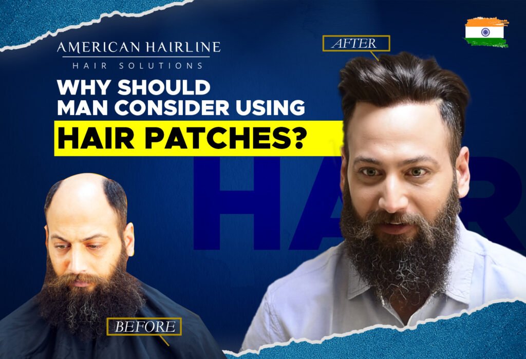 Promotional image for American Hairline Hair Solutions with the headline 'WHY SHOULD MAN CONSIDER USING HAIR PATCHES?' It features a 'before' and 'after' comparison of a man with a full beard. In the 'before' photo on the left, the man has a bald head. In the 'after' photo on the right, the same man has a full head of neatly styled hair. The background is dark blue with a wavy line design at the top. The Indian flag is placed in the top right corner of the image. Large, bold yellow text poses the question about the use of hair patches.