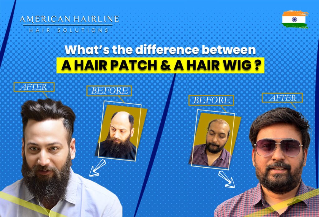 Promotional image for American Hairline Hair Solutions asking 'What's the difference between A HAIR PATCH & A HAIR WIG?' There are two sets of 'before' and 'after' photos displayed. On the left, a man with a receding hairline and a full beard in the 'before' picture, and with a full head of hair styled in a modern fashion in the 'after' picture. On the right, another man with significant hair thinning in the 'before' picture, and with a full head of hair and sunglasses in the 'after' picture. The background is blue with a dotted pattern, and there's an Indian flag in the top right corner. Text and arrows highlight the transformation.