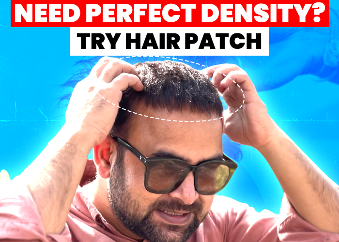 Man adjusting a hair patch on his head while wearing sunglasses, with dotted lines highlighting the hairline area. The text 'Need Perfect Density? Try Hair Patch' is displayed at the top in bold red and black fonts. The background is bright blue, suggesting the image promotes a solution for achieving perfect hair density using a hair patch.