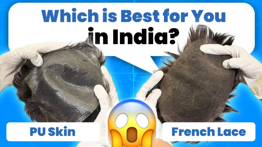 Two hands in gloves holding two types of hair systems—PU Skin on the left and French Lace on the right. Text in the center asks 'Which is Best for You in India?' with an emoji expressing surprise at the bottom. The background features a blue design, and the options 'PU Skin' and 'French Lace' are labeled below each hair system.