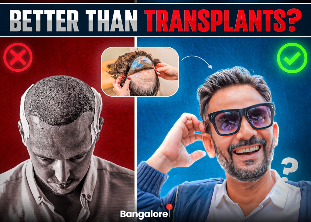 A comparison image showing the downsides of hair transplants versus the benefits of hair systems. On the left, a man with a failed hair transplant is highlighted with a red "X." On the right, a smiling man wearing sunglasses showcases the confidence of using a hair system, marked with a green checkmark. Inset in the center is an image of a hair system being applied. The bold text reads, "Better Than Transplants?" with "Bangalore" pinpointed at the bottom.