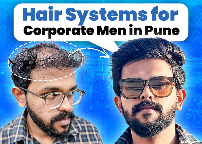 Before and after comparison of a corporate man in Pune using a hair system. The left side shows the individual with visible hair loss, while the right side displays a full, natural-looking hairstyle after using the hair system. Text reads: 'Hair Systems for Corporate Men in Pune'.