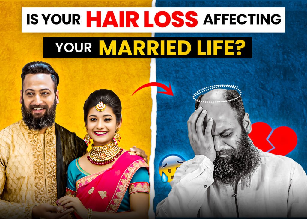 A split image showing the contrasting impact of hair loss on married life. On the left, a happy couple is dressed in traditional Indian attire, smiling and confident. On the right, the man looks distressed with visible baldness, holding his head in frustration, surrounded by a broken heart symbol and a sad emoji. The bold text reads, "Is Your Hair Loss Affecting Your Married Life?" on a vibrant yellow and blue background.