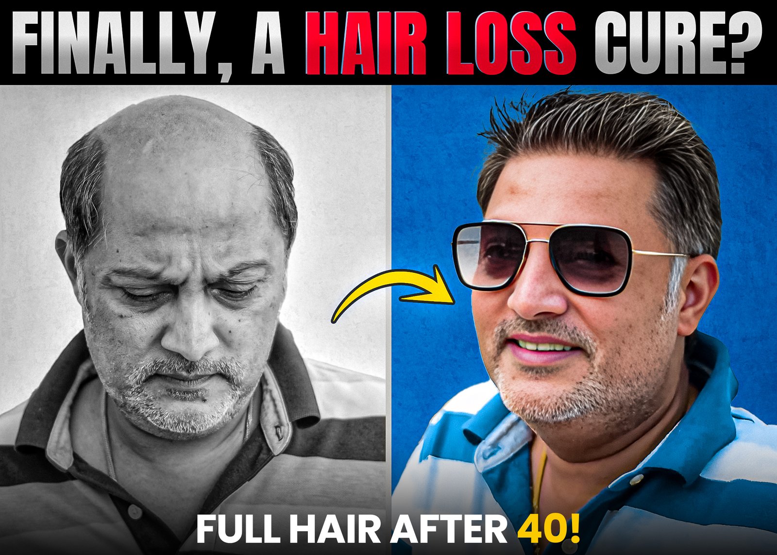 A side-by-side transformation image showcasing a man before and after a hair loss solution. The left side shows the man with visible baldness, appearing somber and in black and white. The right side displays him with a full head of hair, smiling confidently, wearing sunglasses and vibrant colors. The bold text reads, "Finally, A Hair Loss Cure?" with a caption below stating, "Full Hair After 40!"