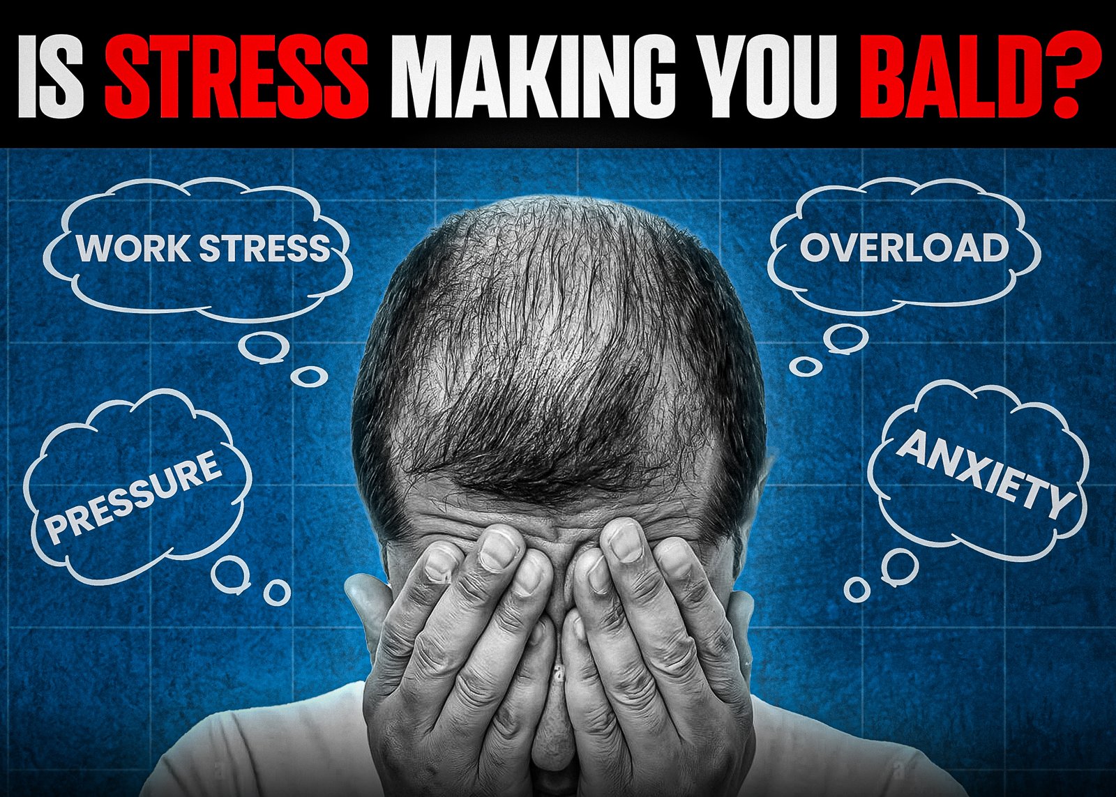 A man with thinning hair covering his face with his hands, surrounded by thought bubbles containing words like "Work Stress," "Pressure," "Overload," and "Anxiety." The bold text at the top reads, "Is Stress Making You Bald?" against a blue textured background.