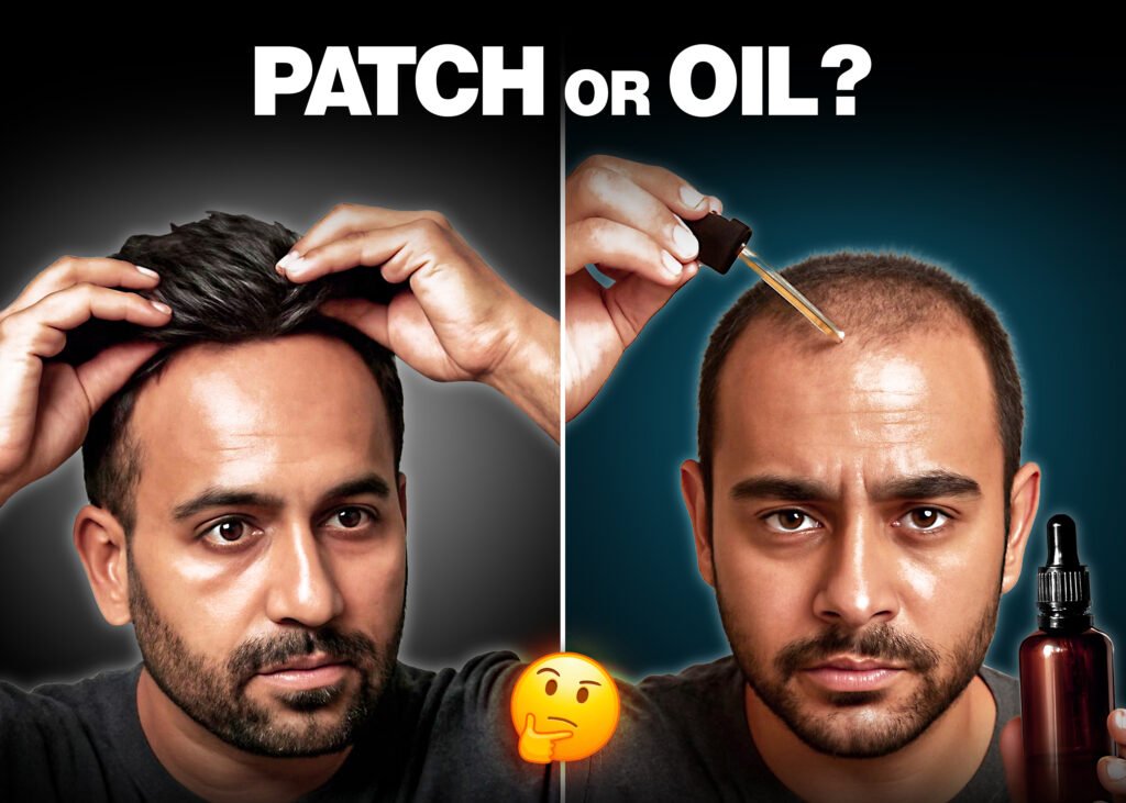 Comparison image of a man using a hair patch for a full head of hair (left) and another applying hair growth oil for thinning hair (right). Caption: 'PATCH or OIL?' highlights hair loss treatment options.
