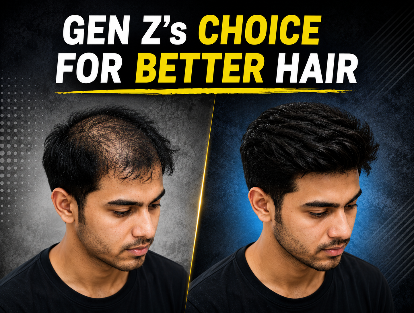 Gen Z's Choice for Better Hair thumbnail showing a young man before and after a non-surgical hair system transformation, highlighting natural-looking hair restoration for young men with hair loss.